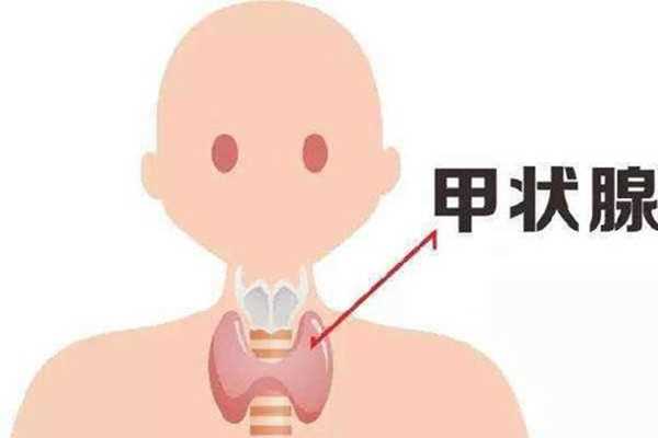 甲状腺结节会导致脖子疼吗 甲状腺结节有什么症状