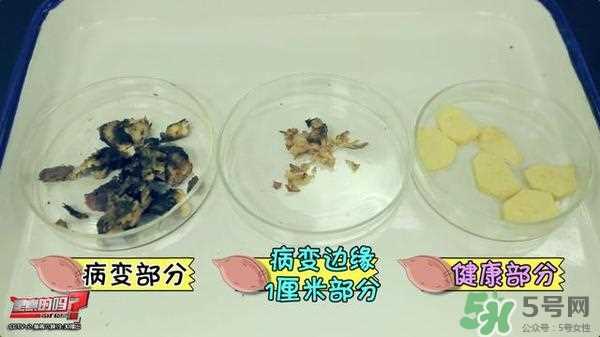 红薯有黑斑能吃么 地瓜有黑点可以吃吗