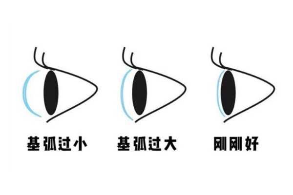 隐形眼镜基弧大好还是小好 