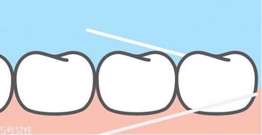 欧乐b牙线使用方法 3个步骤不伤牙龈